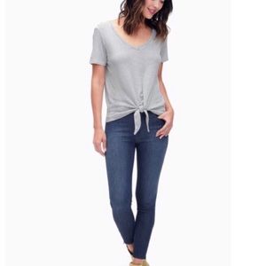 Splendid Ankle Zip Skinny Jeans